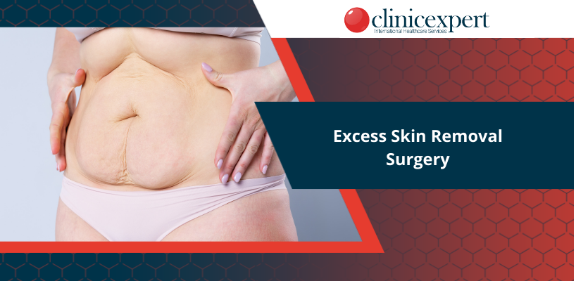 Excess Skin Removal Surgery