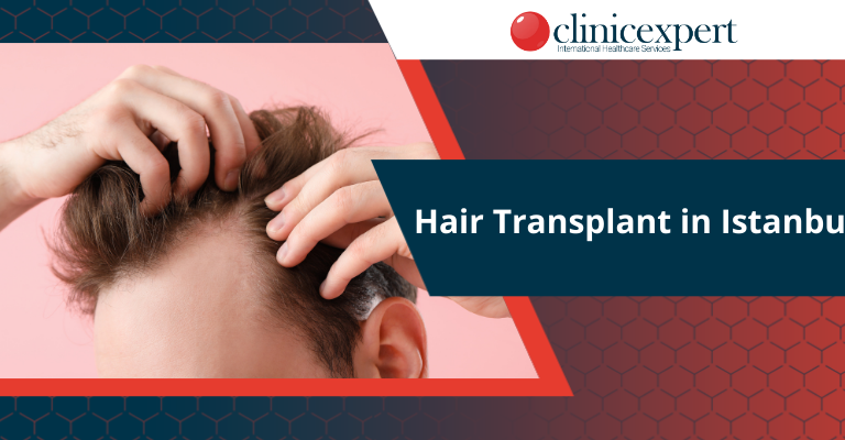 Hair Transplant in Istanbul