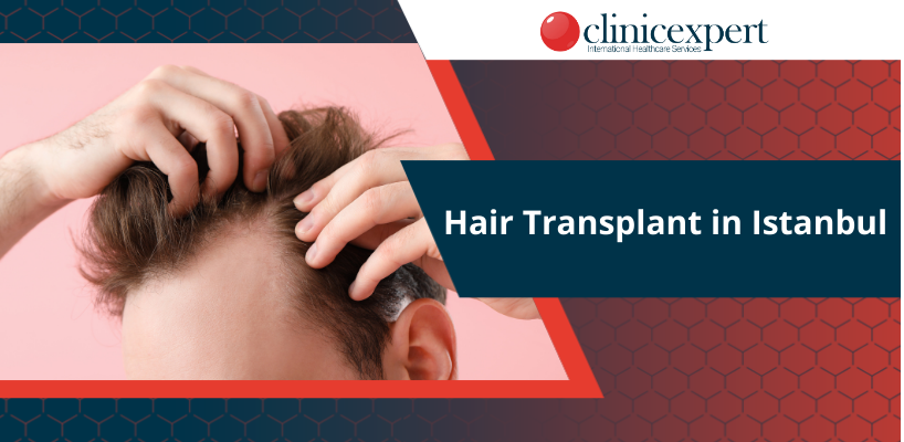 Hair Transplant in Istanbul