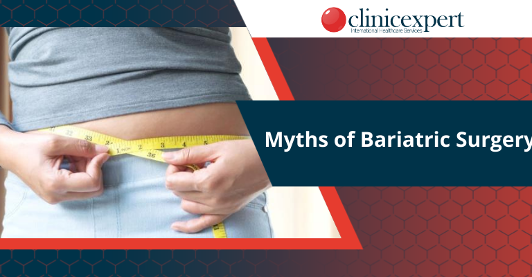 Myths of Bariatric Surgery