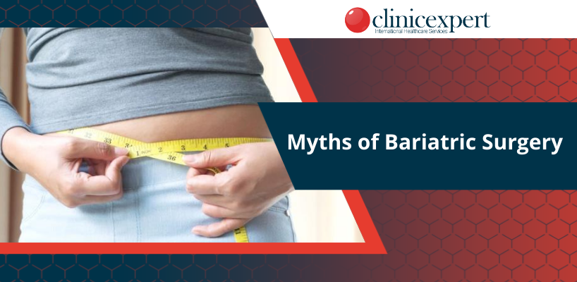 Myths of Bariatric Surgery