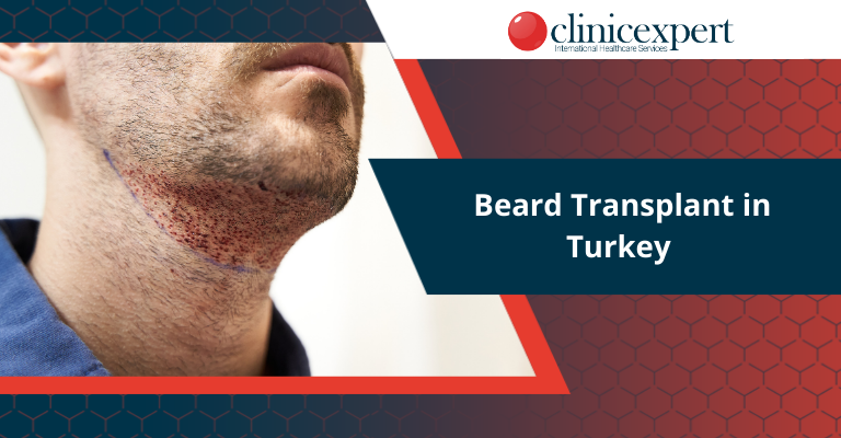 Beard Transplant in Turkey