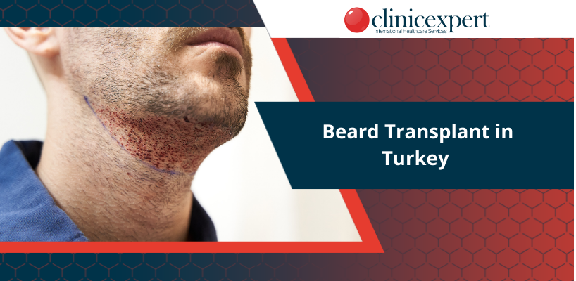 Beard Transplant in Turkey