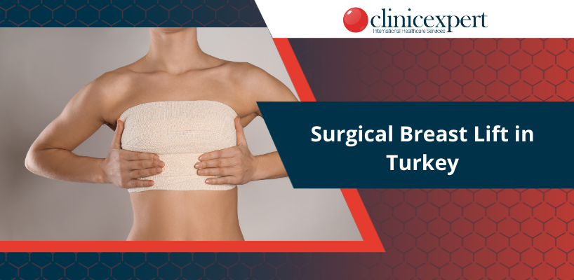 Surgical Breast Lift in Turkey