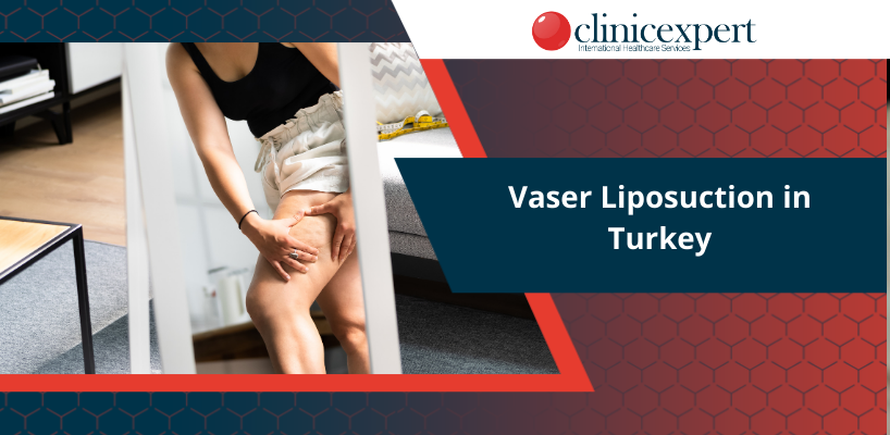 Vaser Liposuction in Turkey