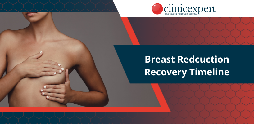Breast Reduction Recovery Timeline
