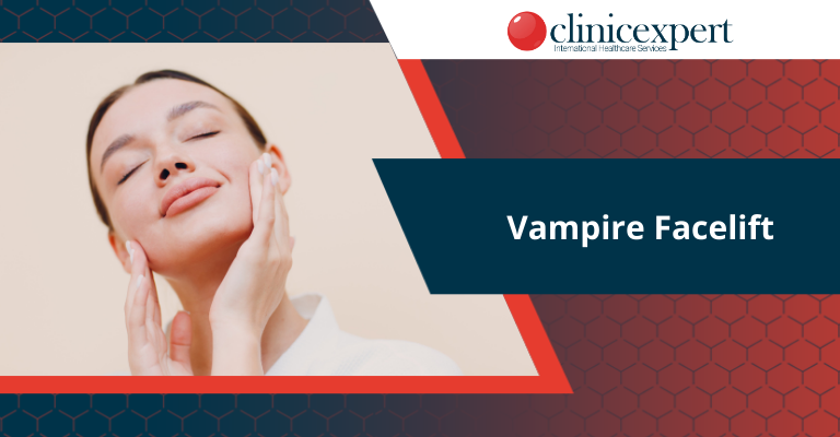 Vampire Facelift