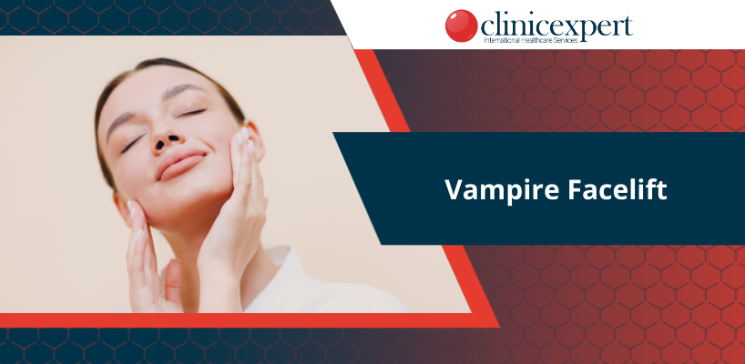 Vampire Facelift