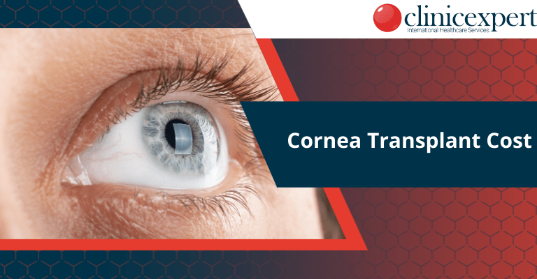 How-Much-Does-Cornea-Transplant-Cost