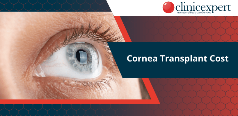 How-Much-Does-Cornea-Transplant-Cost