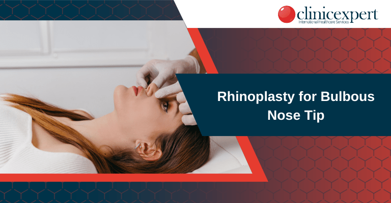 Rhinoplasty for Bulbous Nose Tip