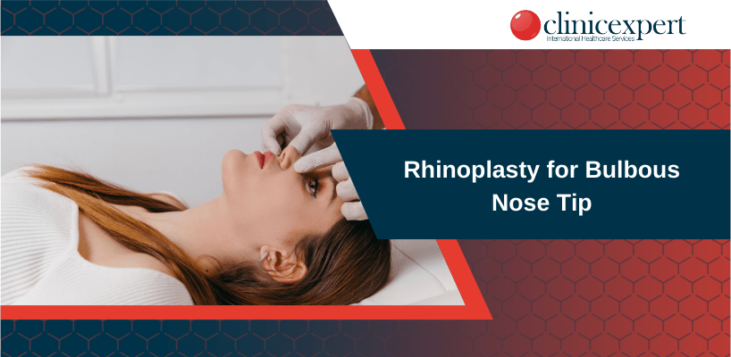 Rhinoplasty for Bulbous Nose Tip