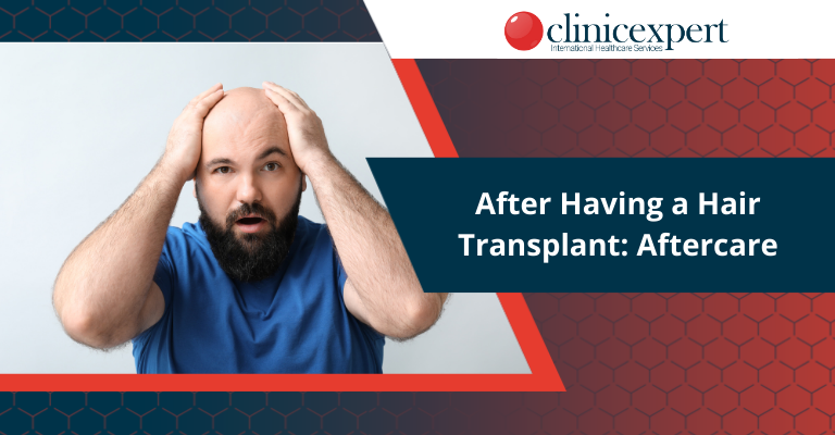 After Having a Hair Transplant: Aftercare