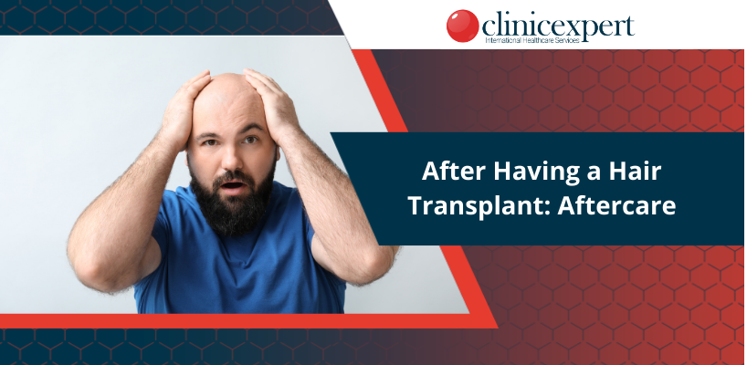 After Having a Hair Transplant: Aftercare