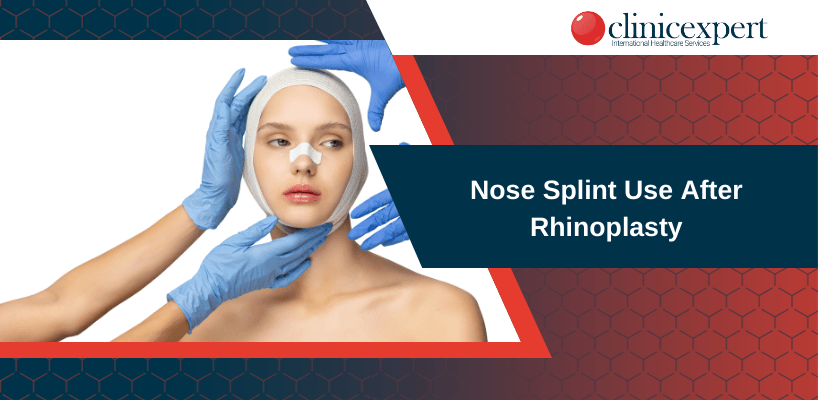 Nose Splint Use After Rhinoplasty