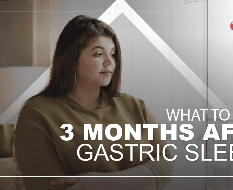 3-months-after-gastric-sleeve-min