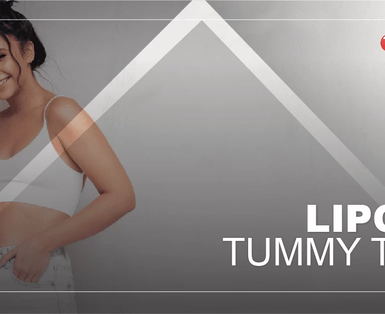 liposuction-vs-tummy-tuck