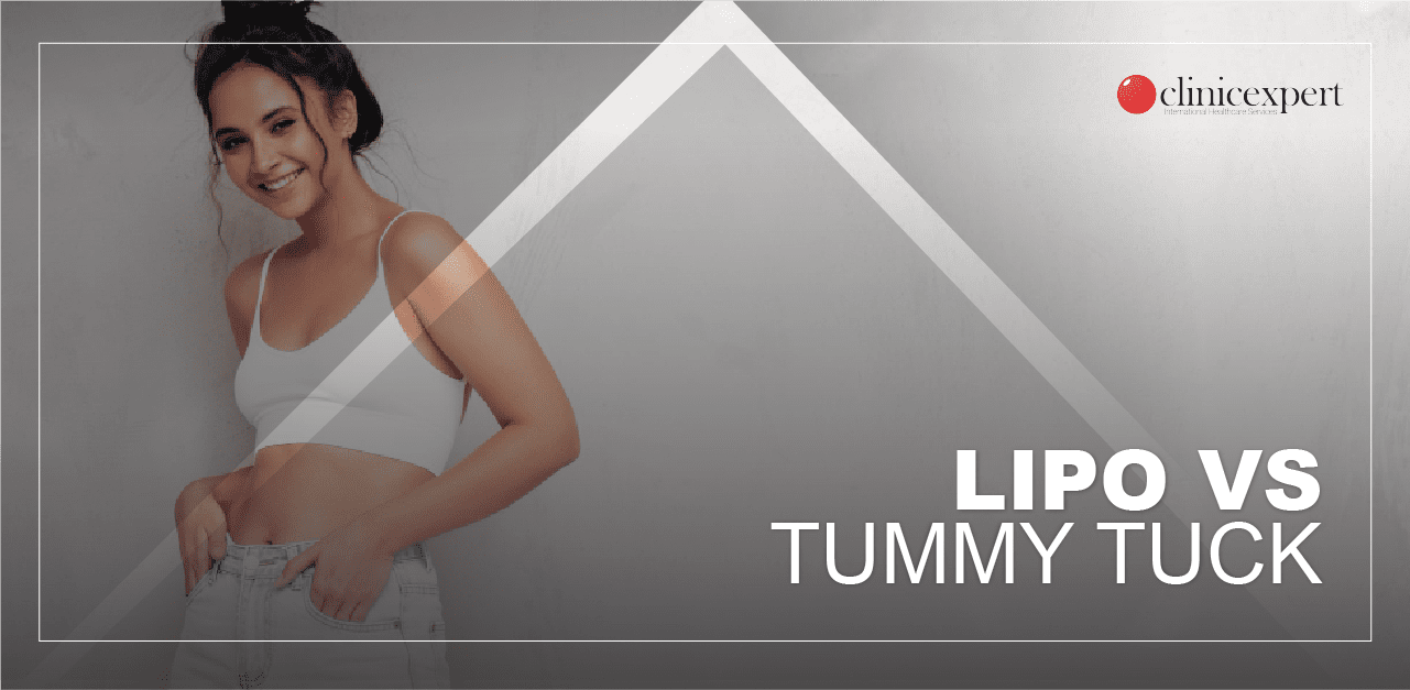 Liposuction vs Tummy Tuck: Which Is Better?