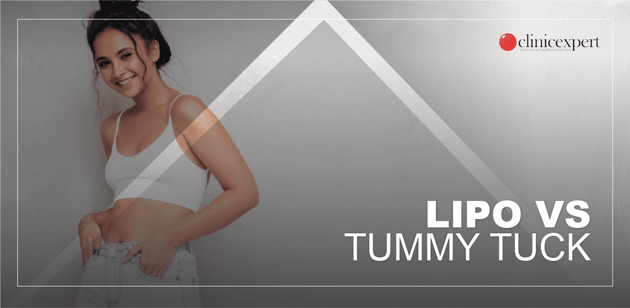 Liposuction vs Tummy Tuck (Abdominoplasty)