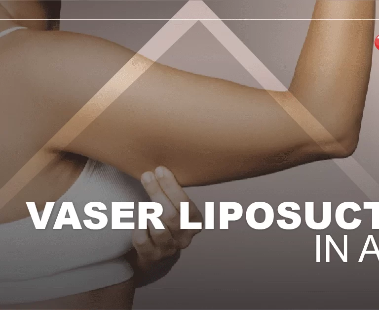 liposuction-in-arms