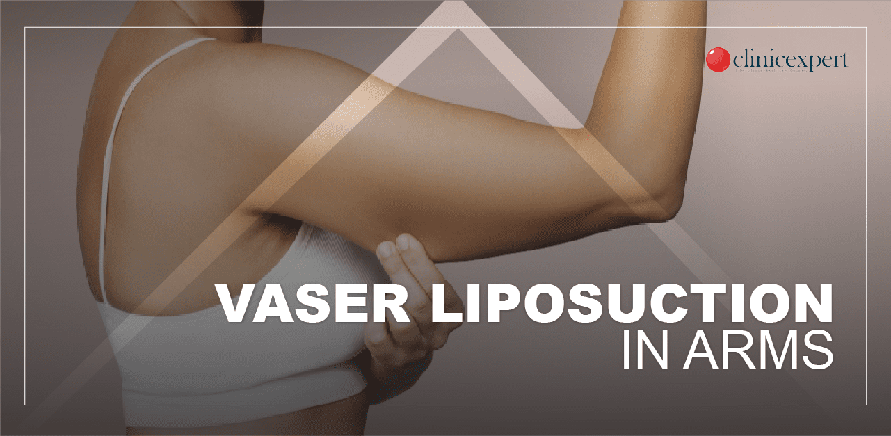 Importance of Wearing a Compression Garment after Arm Lipo