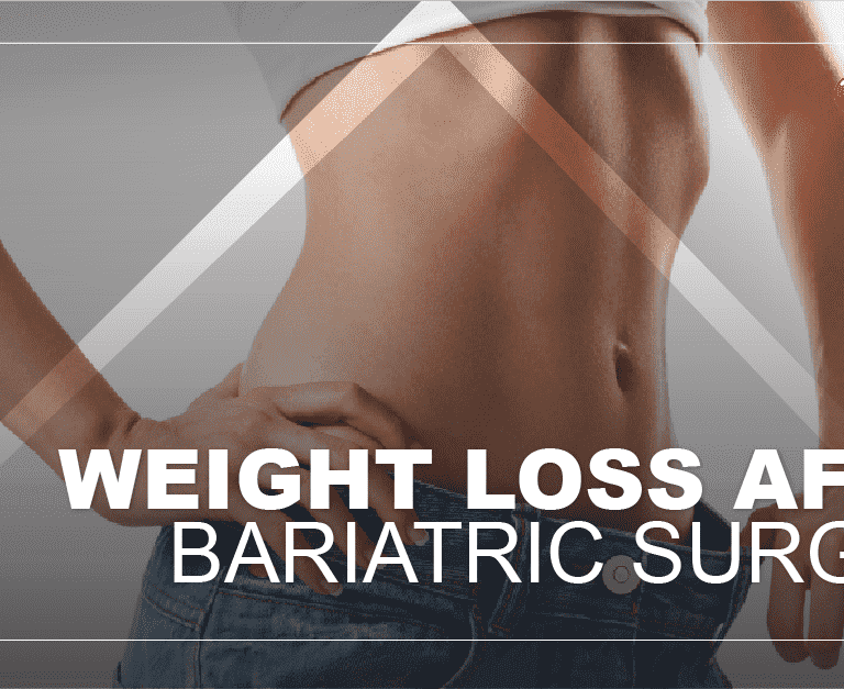 weight-loss-after-bariatric-surgery-min