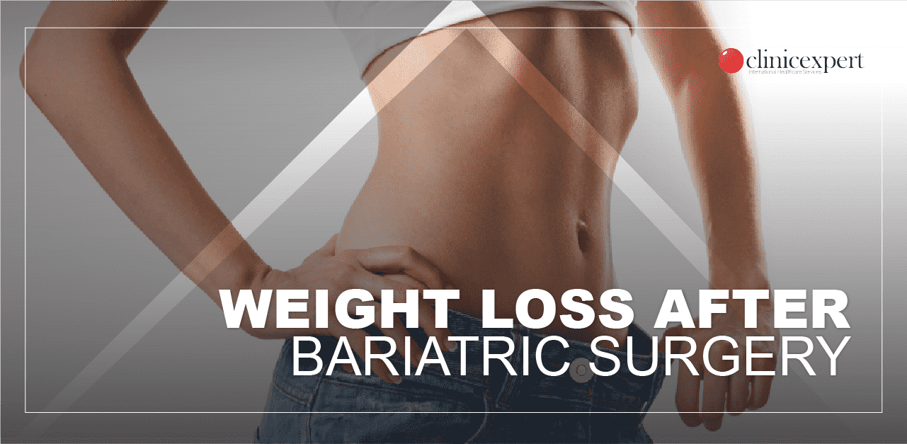 weight-loss-after-bariatric-surgery-min