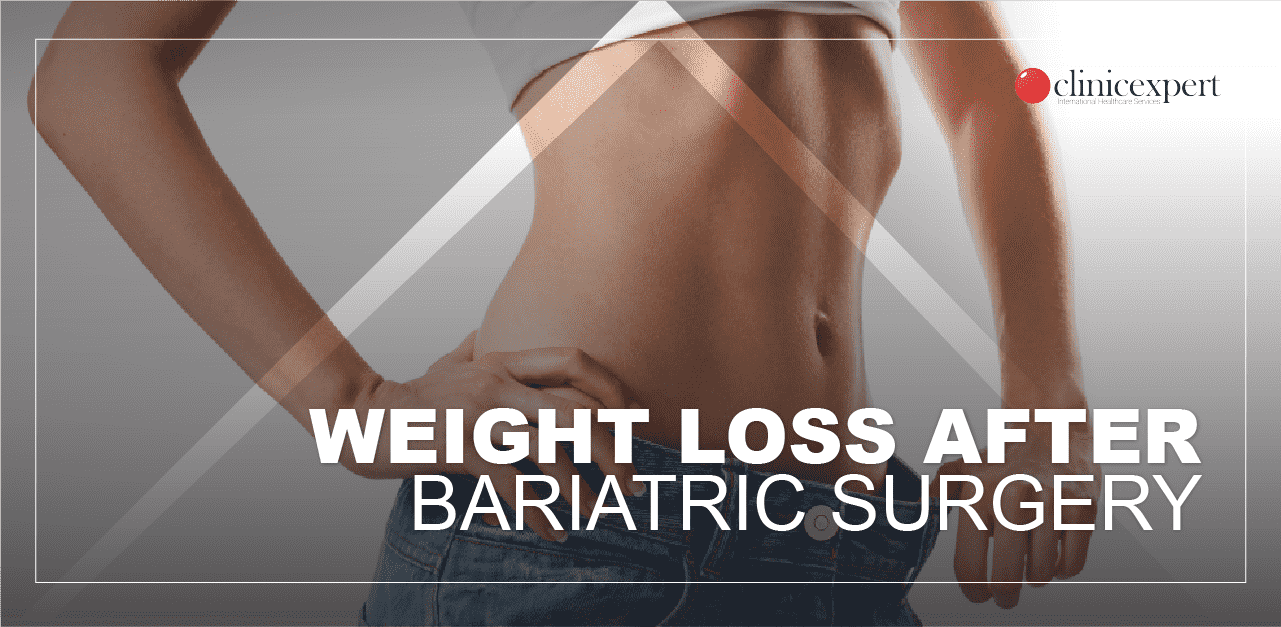Expected Weight Loss After Bariatric Surgery ClinicExpert