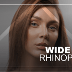 wide-nose-rhinoplasty