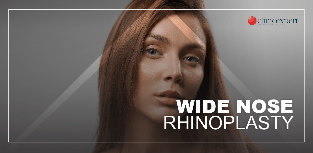 wide-nose-rhinoplasty
