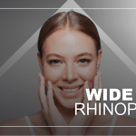 wide-nose-rhinoplasty