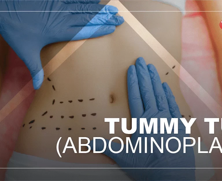 Tummy Tuck in Turkey