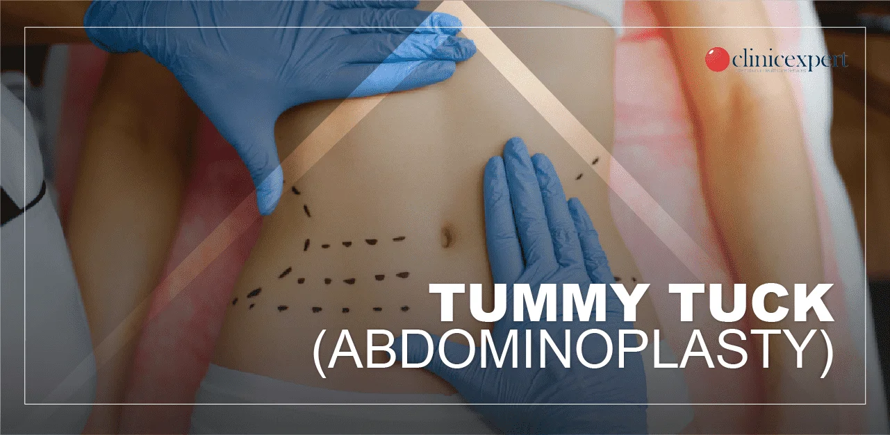 Tummy Tuck in Turkey