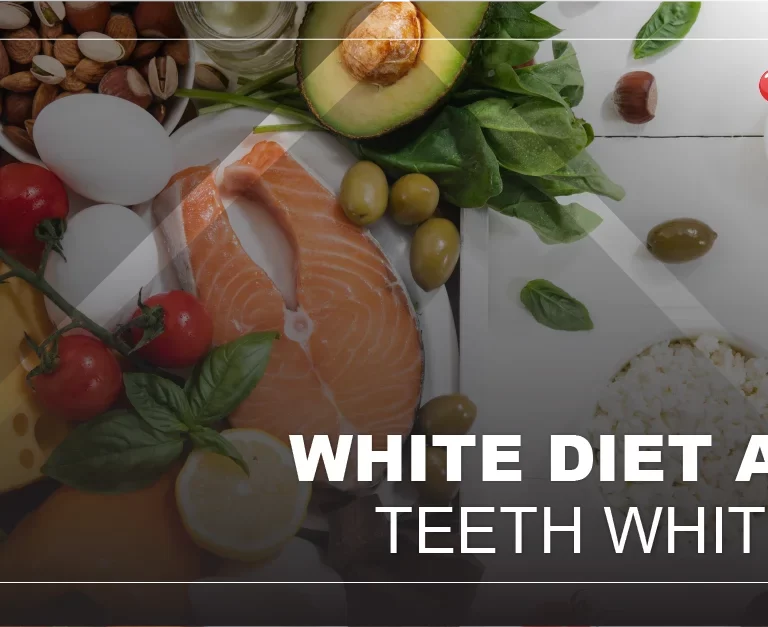 what-to-eat-after-teeth-whitening
