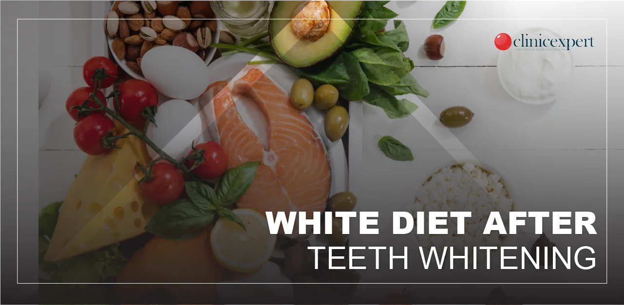 what-to-eat-after-teeth-whitening