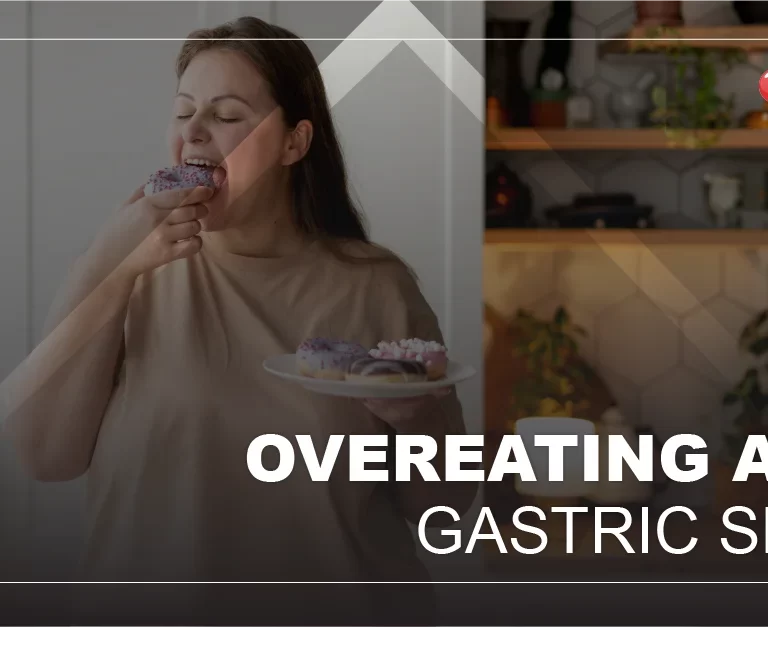 overeating-and-binge-eating-after-gastric-sleeve