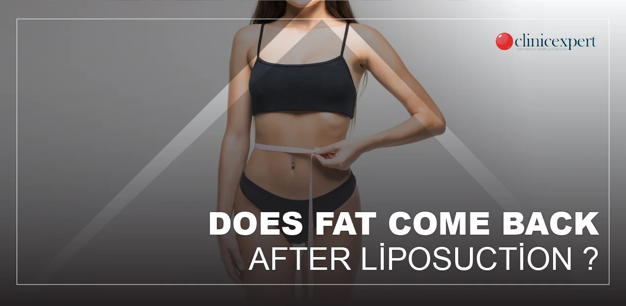 Does Fat Come Back after Liposuction