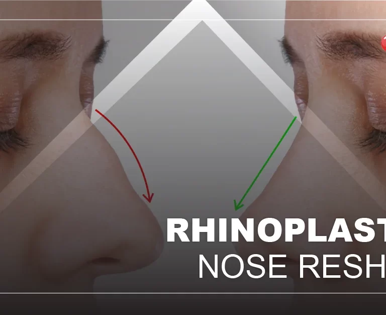 Nose Reshaping