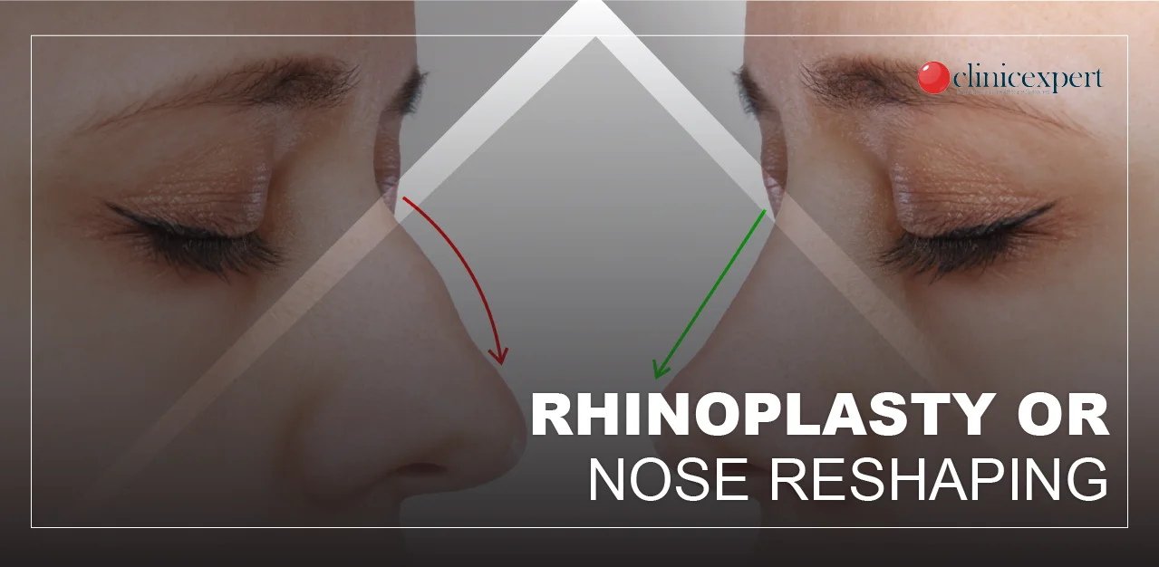 Nose Reshaping