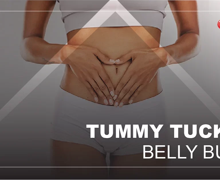 tummy-tuck-belly-button