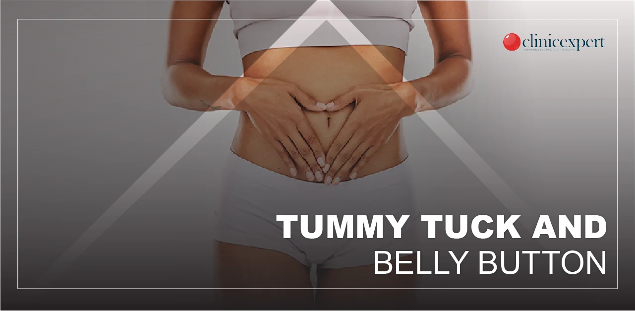 tummy-tuck-belly-button