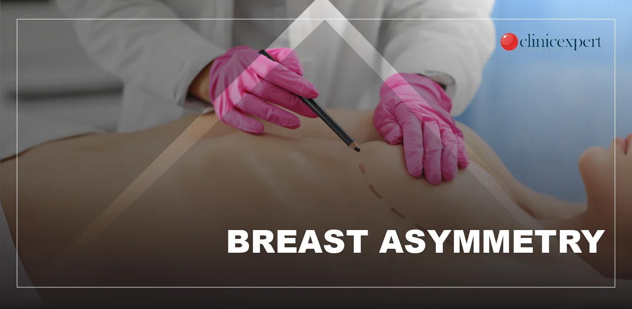 How to Fix Uneven Breast? Asymmetry in Breasts