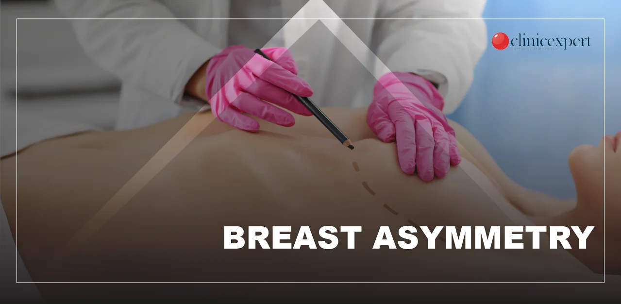 asymmetry in breast