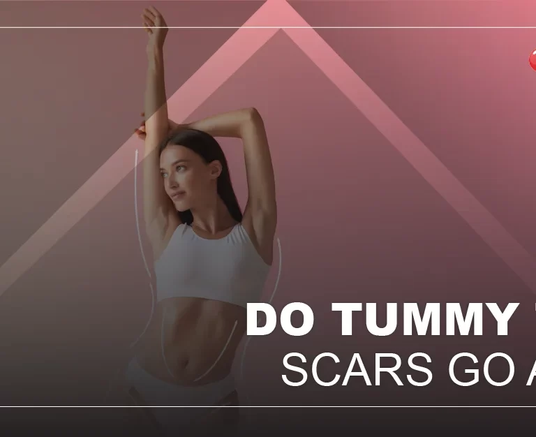 DO TUMMY TUCK SCARS GO AWAY