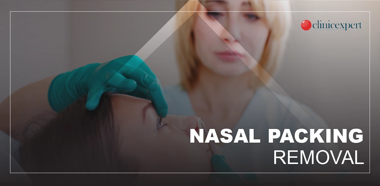 nasal-packing-removal