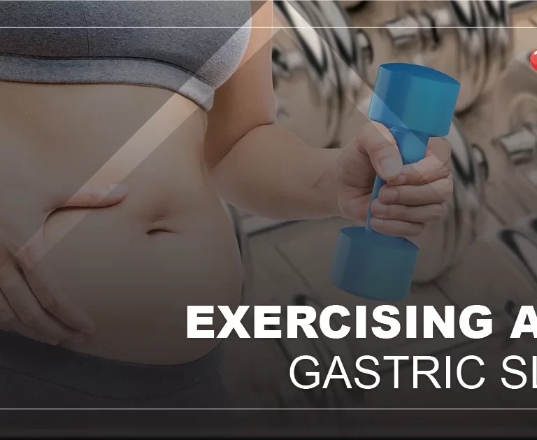 exercising-after-gastric-sleeve
