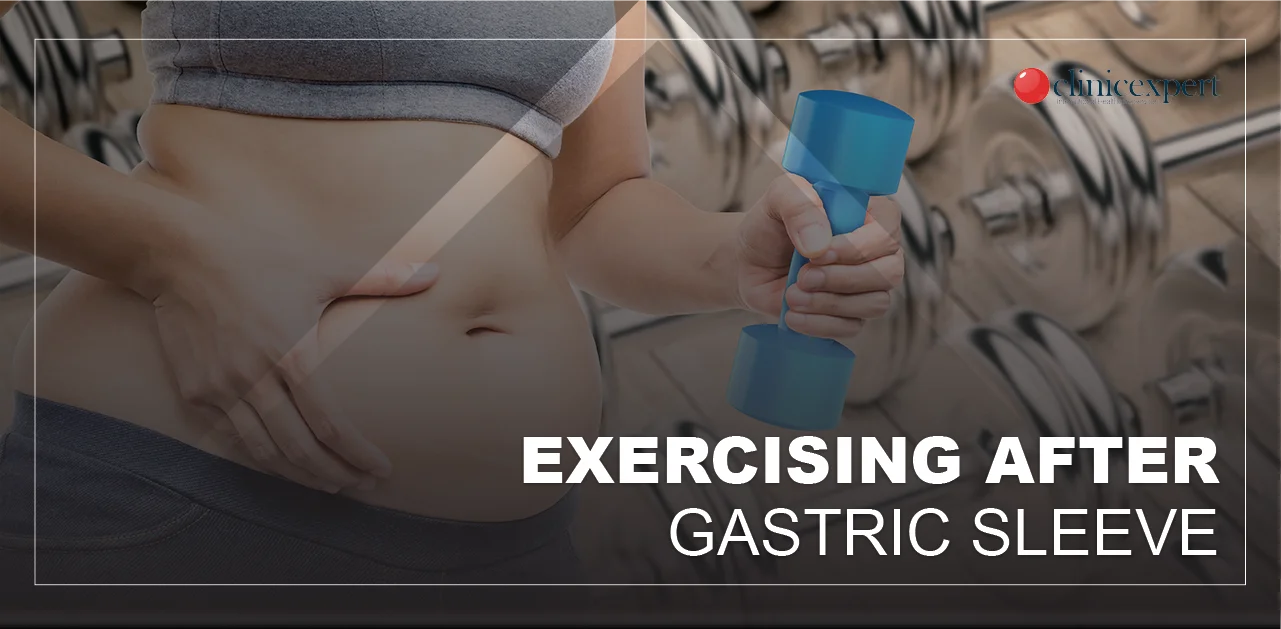 exercising-after-gastric-sleeve