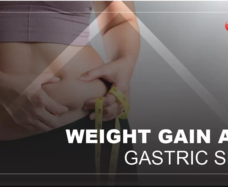 gaining weight after gastric sleeve