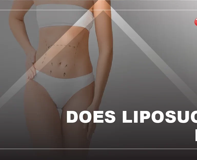 is-liposuction-painful