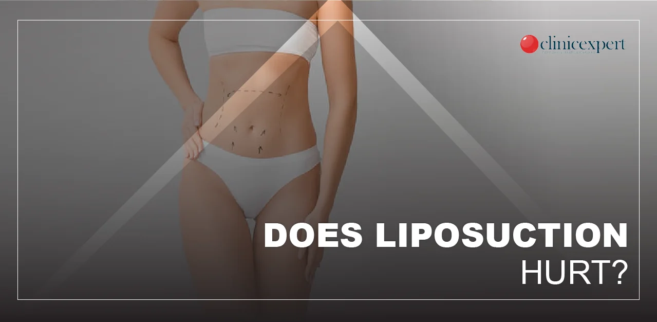 is-liposuction-painful